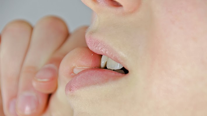 Dicas que ajudam a parar de roer as unhas. Foto: Reprodução de Internet