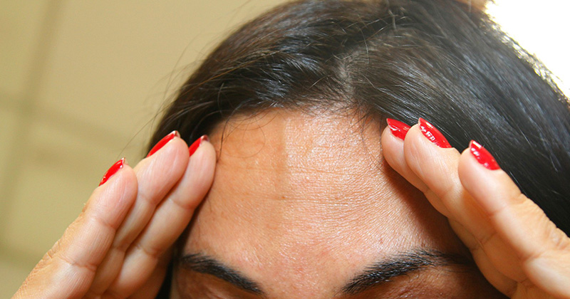 Mulher com dor de cabeça. Foto: Reprodução de Internet