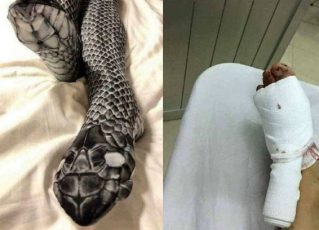 Meia-calça de 'cobra' leva mulher para hospital por assustar marido. Foto: Reprodução de Internet