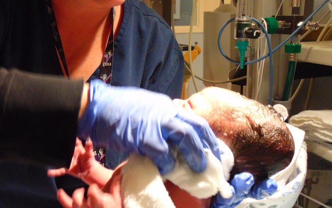 Obstetra é suspenso após bebê nascer sem rosto em Portugal. Foto: Reprodução de Internet