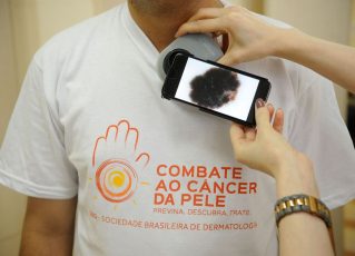 Pacientes são examinados durante campanha do Dia Nacional de Combate ao Câncer de Pele no Hospital Federal de Ipanema. Foto: Fernando Frazão/Agência Brasil
