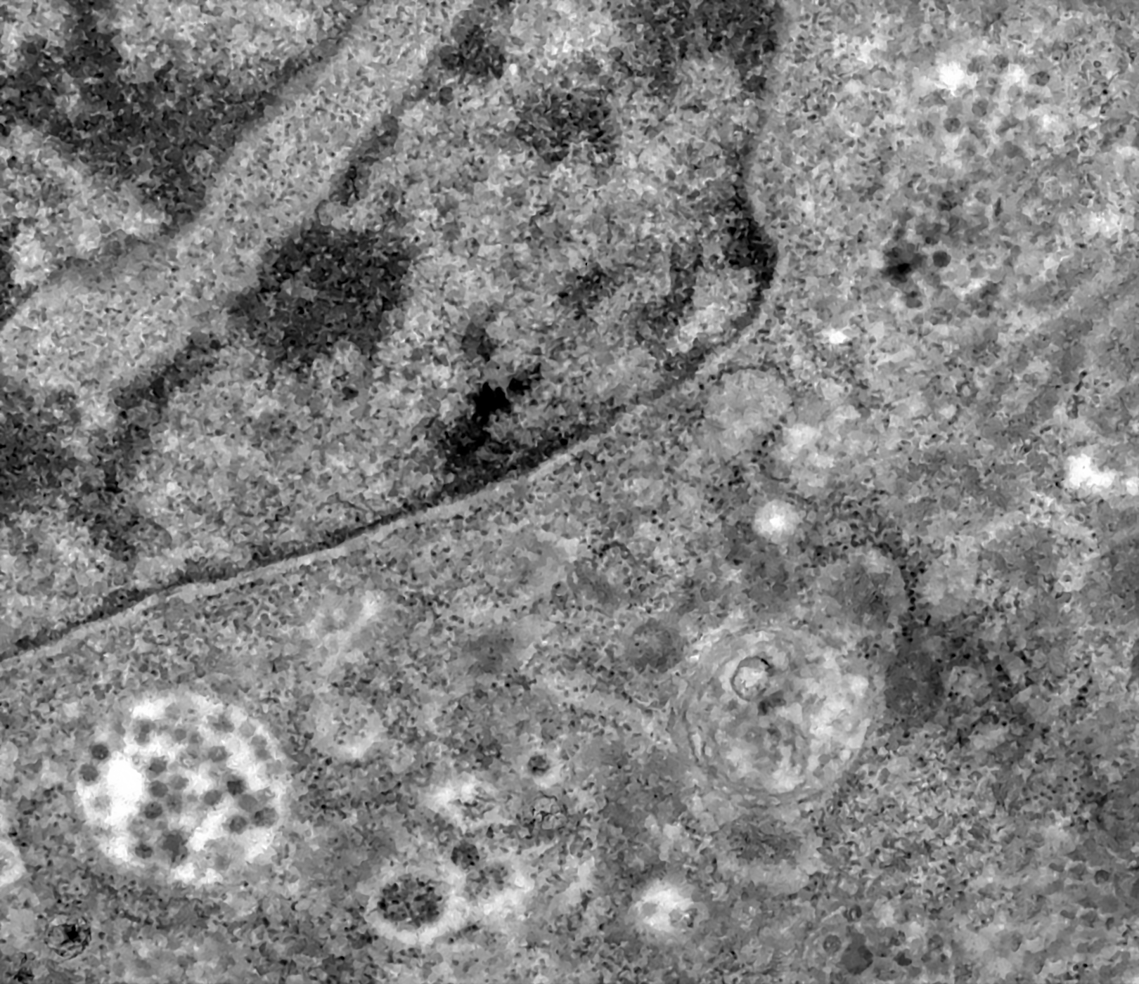 Ковид это вирус. Вирус SARS-cov-2 под микроскопом. Вирус ковид 19 электронная микроскопия. Вирус Covid 19 под микроскопом. Covid-19 под микроскопом.